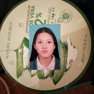面部不对称矫正