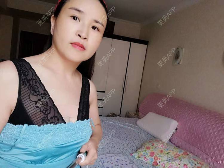曼曼丽的自体脂肪隆胸日记 | 自体脂肪隆胸 | 丰胸(隆胸) | 乳房