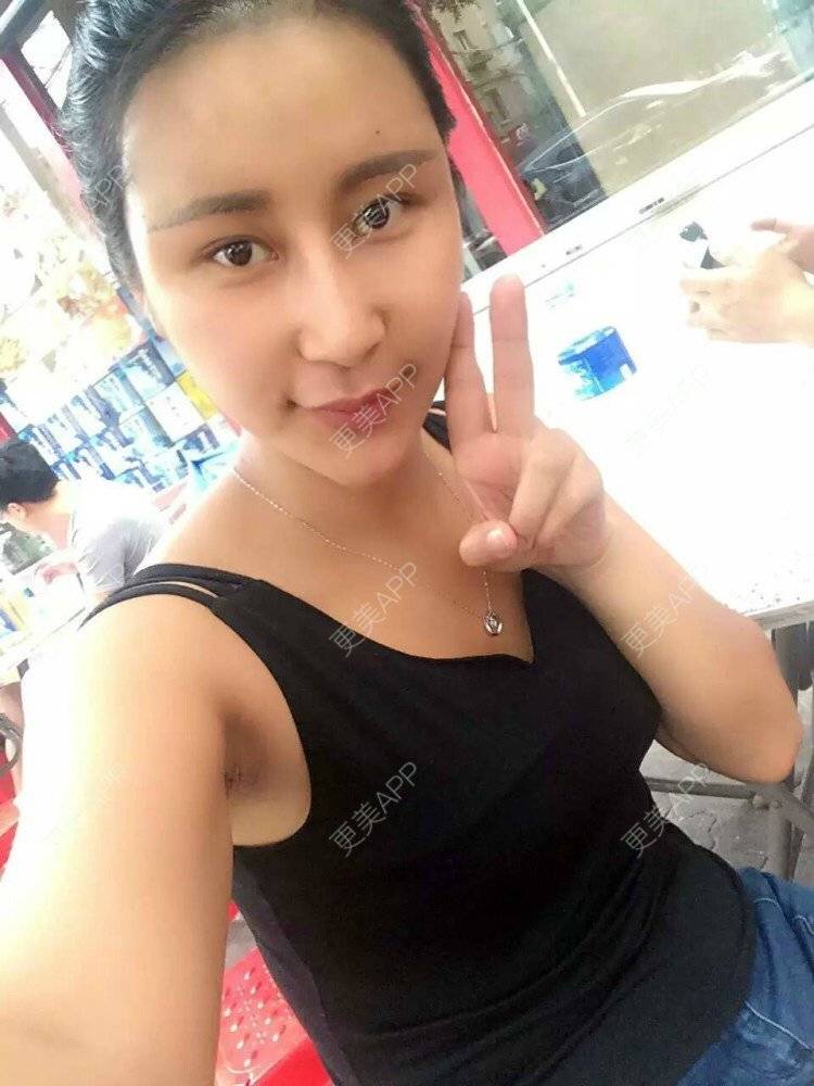 袁娅楠的鼻综合日记