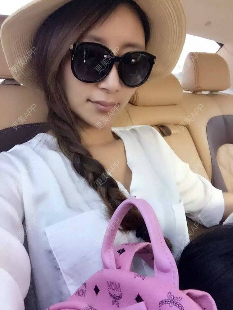 更美 - 袁娅楠的鼻部多项日记 | 自体软骨垫鼻尖 | 耳软骨隆鼻 | 鼻部