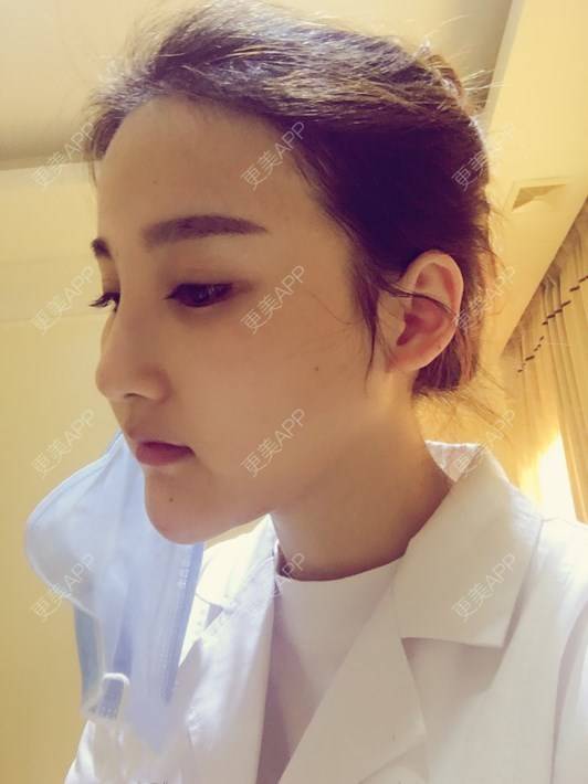 更美 - 赵艳 医生的除皱瘦脸经验 | 除皱瘦脸 | 嘉兴