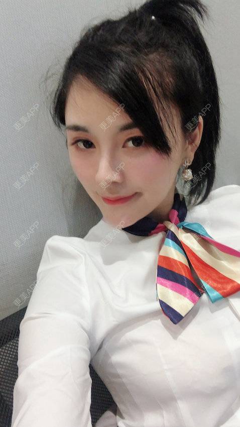 更美 - 浅夏微凉L的双下巴吸脂经验 | 深圳 | 双下巴吸脂