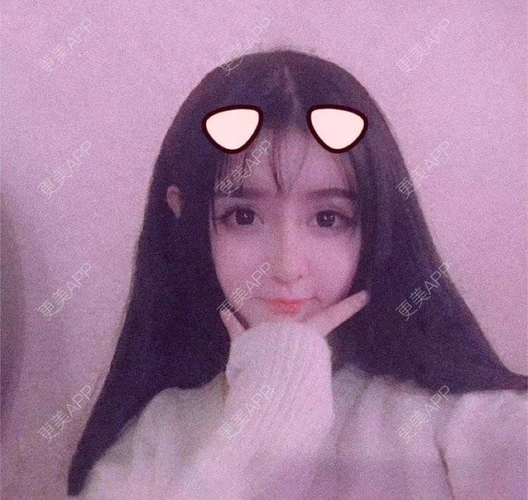 更美 - 老街上的猫的吸脂瘦脸经验 | 南昌 | 视频日记 | 吸脂瘦脸