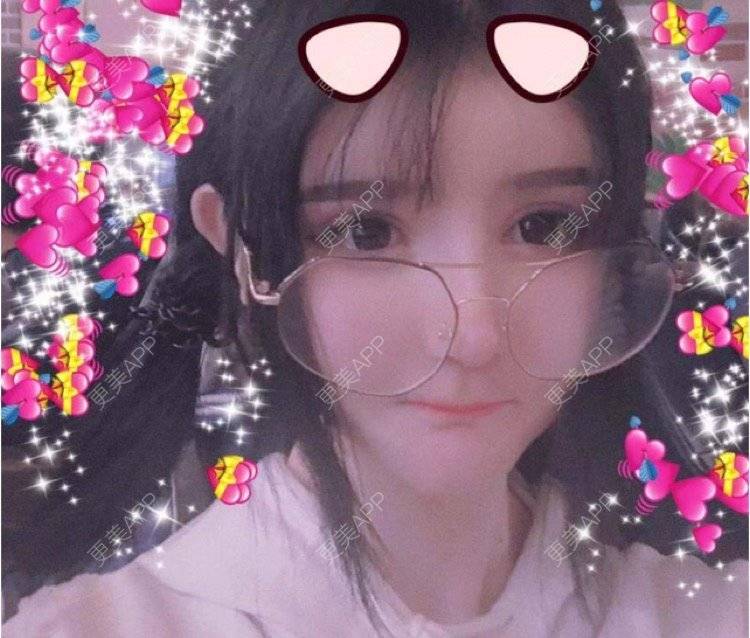 更美 - 老街上的猫的吸脂瘦脸经验 | 南昌 | 视频日记 | 吸脂瘦脸