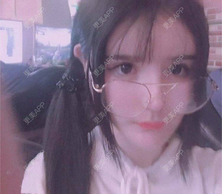 更美 - 老街上的猫的吸脂瘦脸经验 | 南昌 | 视频日记 | 吸脂瘦脸