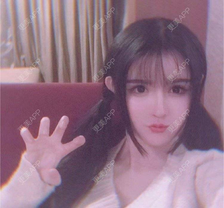 更美 - 老街上的猫的吸脂瘦脸经验 | 南昌 | 视频日记 | 吸脂瘦脸