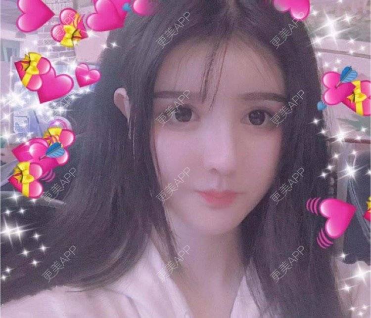 更美 - 老街上的猫的吸脂瘦脸经验 | 南昌 | 视频日记 | 吸脂瘦脸