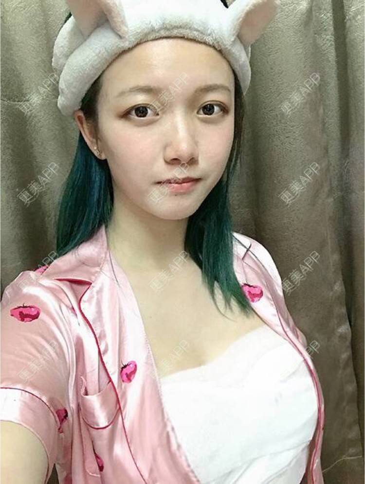 更美 - 袭人旅的假体隆胸经验 | 广州 | 假体隆胸 | 根管治疗 | 深圳