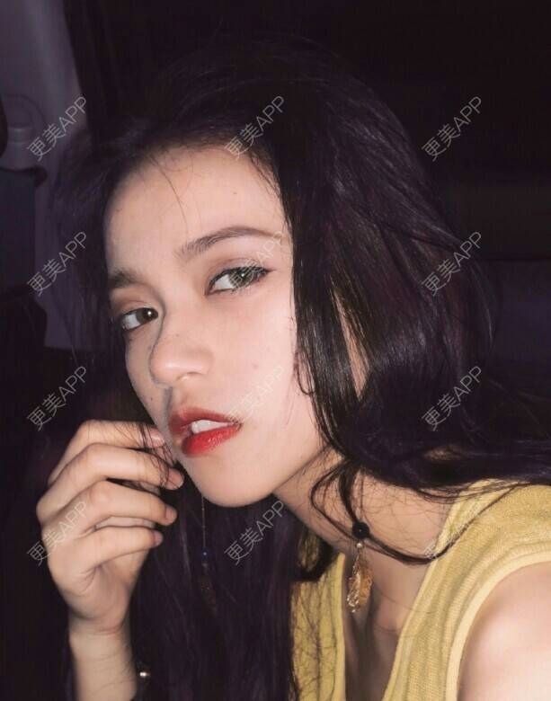 更美 - 欧美范心情的拔龋齿经验 | 成都 | 拔龋齿