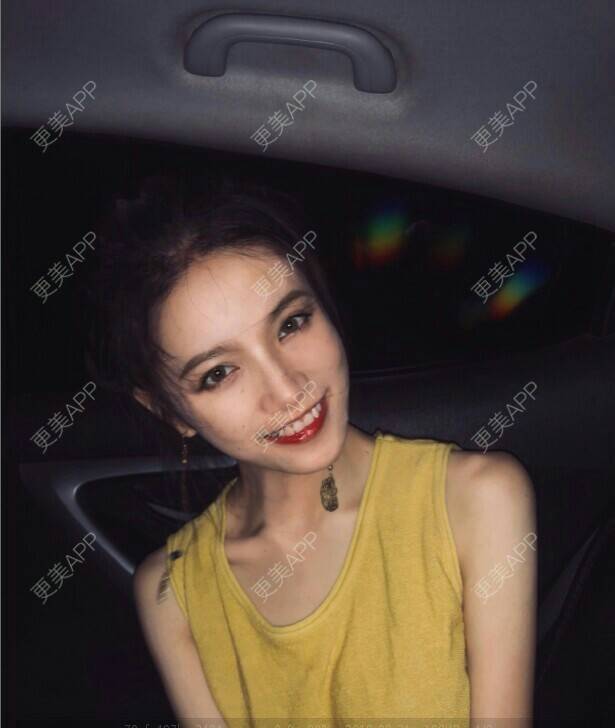 更美 - 欧美范心情的拔龋齿经验 | 成都 | 拔龋齿