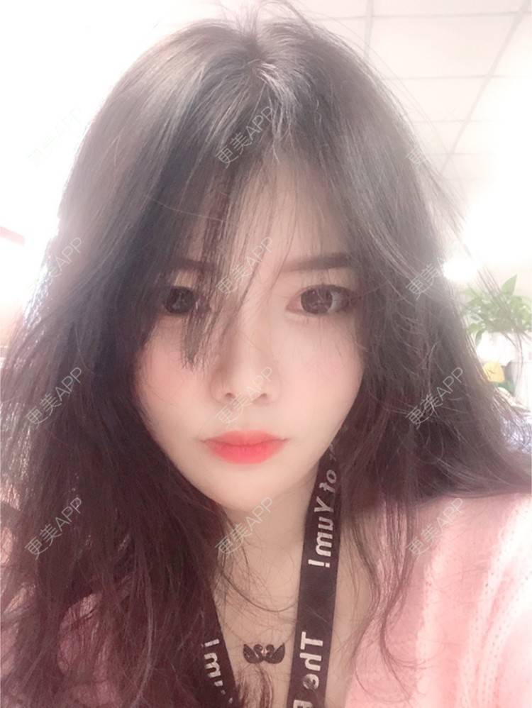 更美 - yuki666的玻尿酸经验 | 深圳 | 像素激光 | 鼻部综合 | 胸部修复 | 杭州 | 武汉 | 玻尿酸