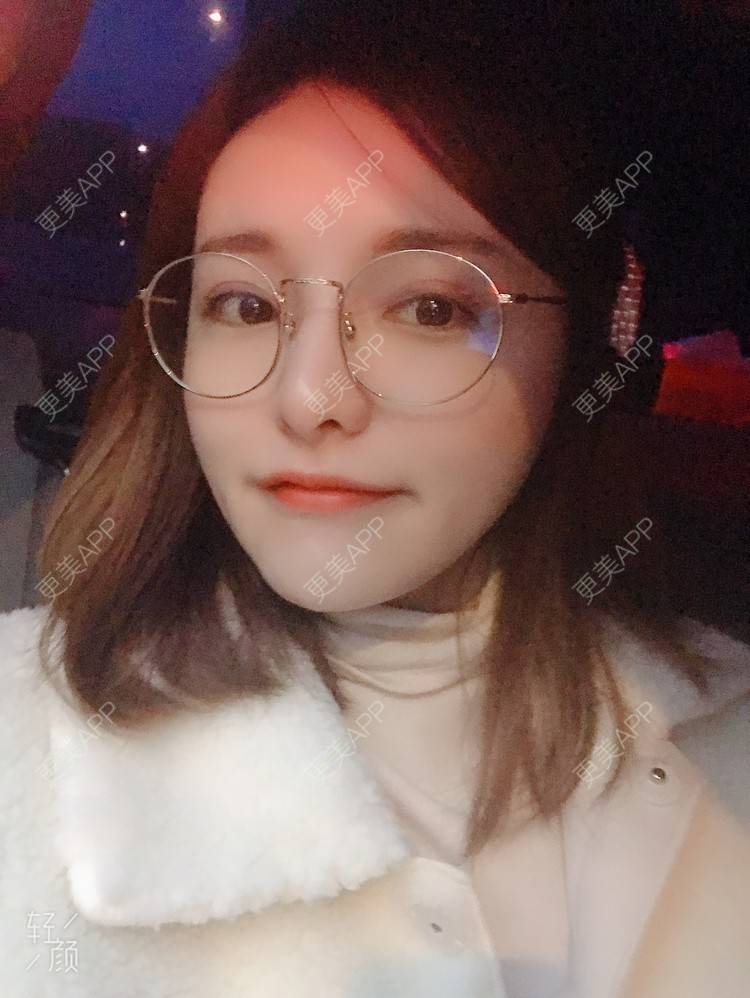 更美 - 小小恩菲的耳软骨隆鼻经验 | 视频日记 | 耳软骨隆鼻 | 重庆