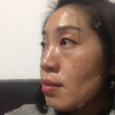 眼部多项