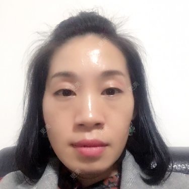 眼部多项