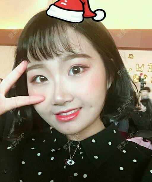 更美 - 飙车人的拔龋齿经验 | 成都 | 拔龋齿