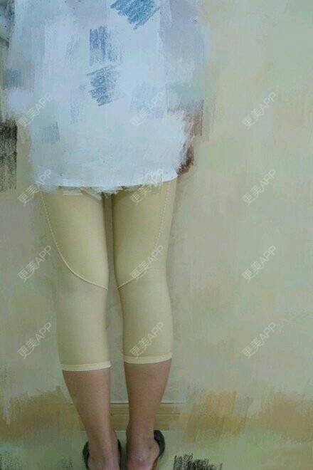 更美 - 更美用户OECkflBxqZ的吸脂经验 | 西安 | 北京 | 水光项目 | 大连 | 双眼皮 | 上海 | 超声提升 | 吸脂瘦脸 | PRP自体血清美肤 | 广州 | 南昌 | 吸脂 | 种植牙