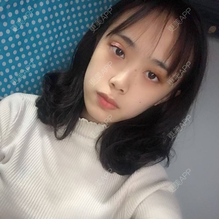 更美 - 王艳 医生的双眼皮经验 | 双眼皮 | 嘉兴