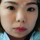 鼻部综合
