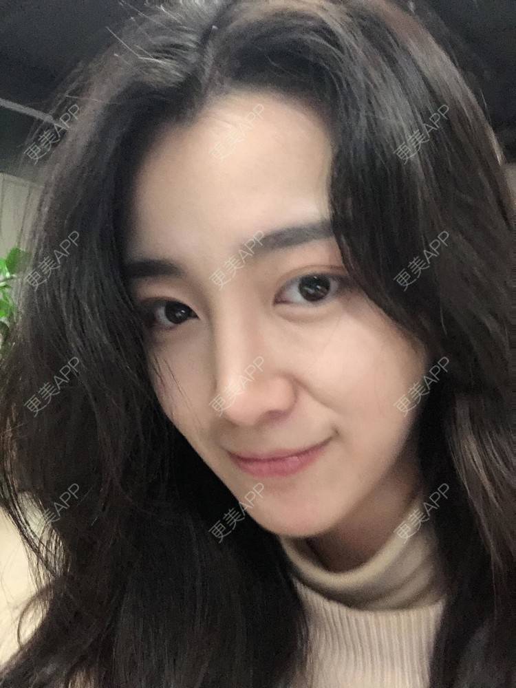 更美 - 范萌知 医生的隆鼻经验 | 隆鼻 | 嘉兴