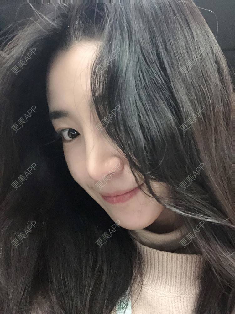 更美 - 范萌知 医生的隆鼻经验 | 隆鼻 | 嘉兴