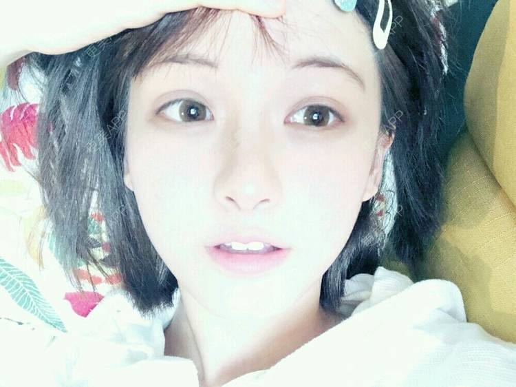更美 - 春风吹梦的全瓷牙经验 | 成都 | 全瓷牙