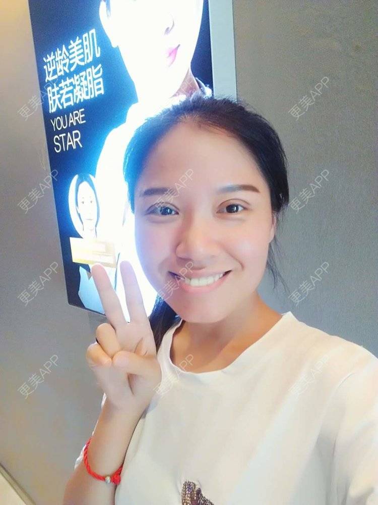 更美 - 更美用户5Pz3SpoBlS的果酸焕肤经验 | 济南 | 果酸焕肤