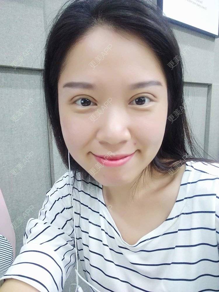 更美 - 更美用户5Pz3SpoBlS的果酸焕肤经验 | 济南 | 果酸焕肤