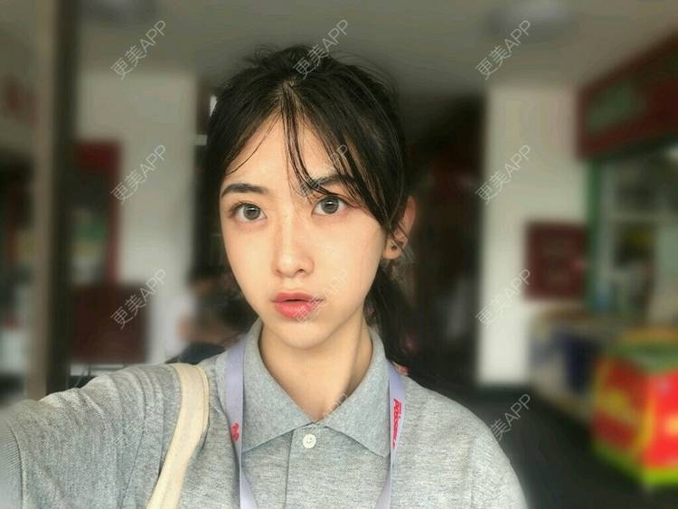 更美 - 仰望着你的超声波洗牙经验 | 成都 | 超声波洗牙