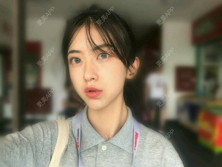 更美 - 仰望着你的超声波洗牙经验 | 成都 | 超声波洗牙