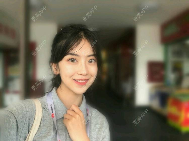 更美 - 仰望着你的超声波洗牙经验 | 成都 | 超声波洗牙