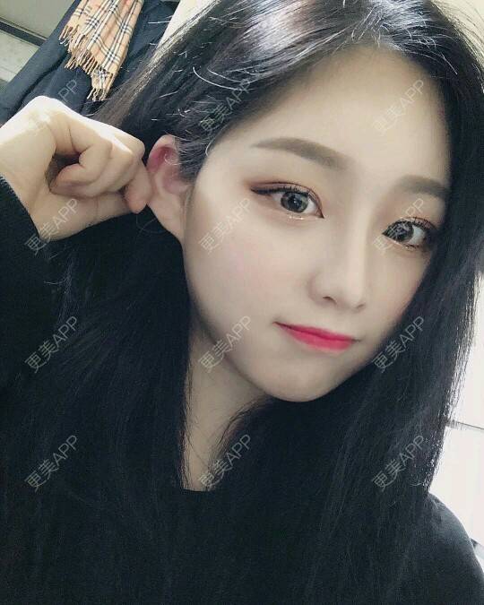 更美 - 更美用户crt1w6PLR8的鼻部多项经验 | 丰胸（隆胸） | 眼部综合 | 激光脱毛 | 下颌角 | 假体隆胸 | 除皱瘦脸 | 鼻部多项 | 淡化皱纹 | PRP自体血清美肤 | 玻尿酸 | 鼻部综合 | 上海