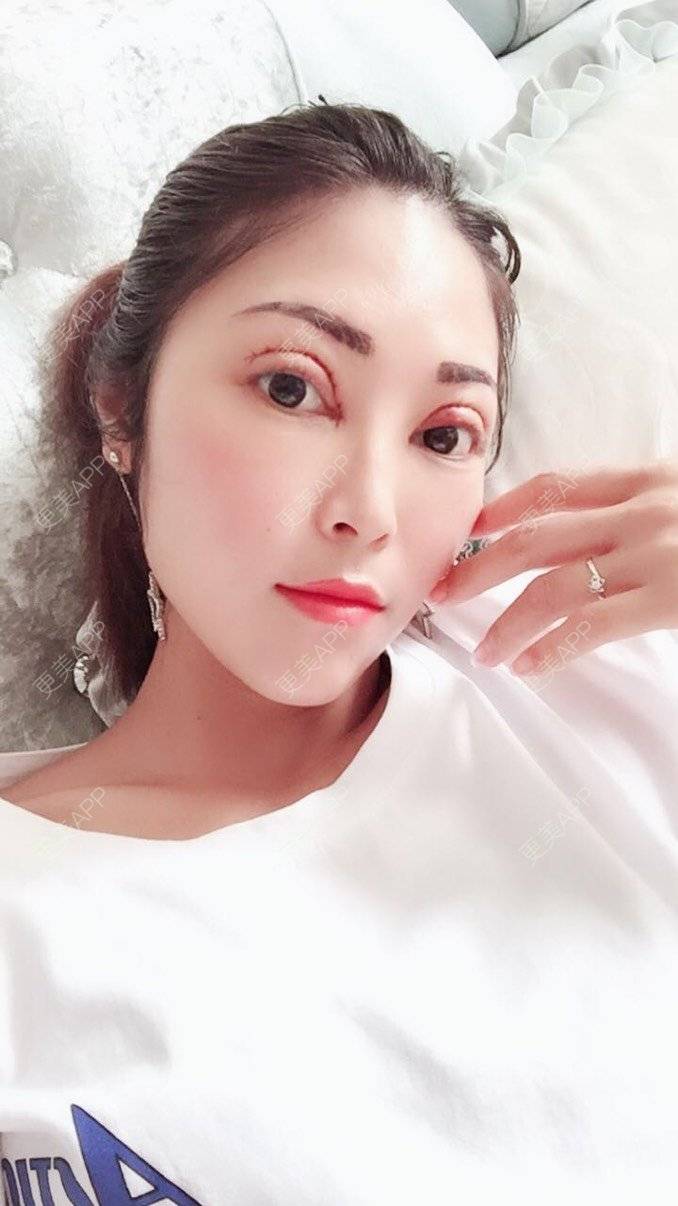 洋洋的沫沫的全切双眼皮日记