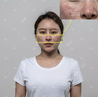 重庆美莱整形美容医院