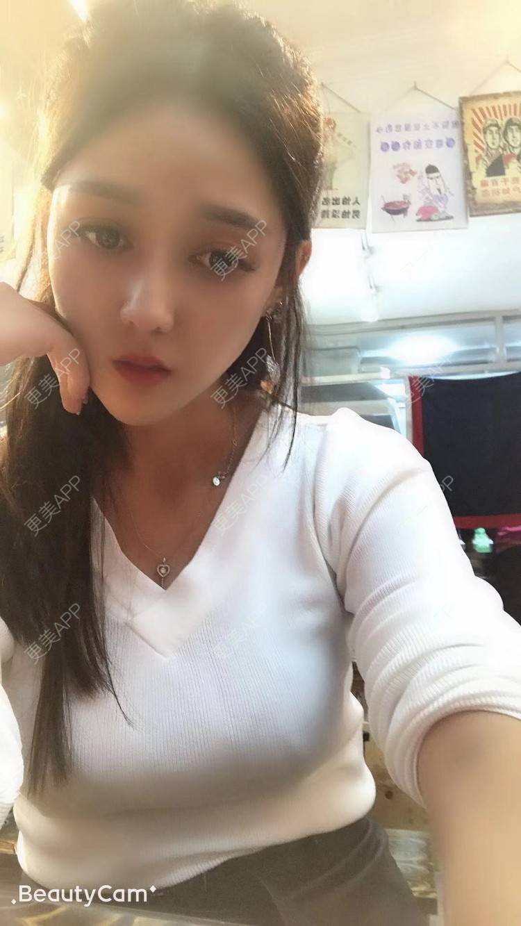 更美 - 玫瑰紫的轮廓修复术经验 | 轮廓修复术