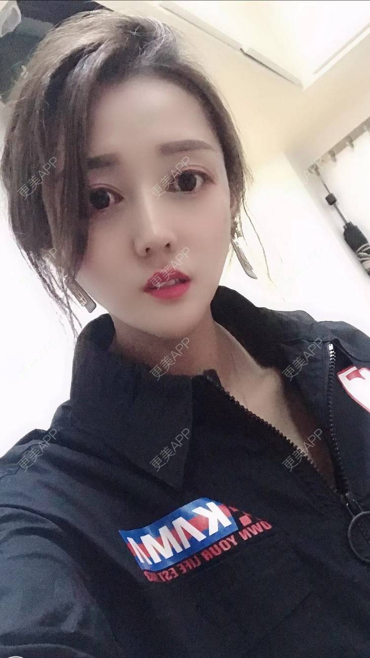 更美 - 玫瑰紫的轮廓修复术经验 | 轮廓修复术