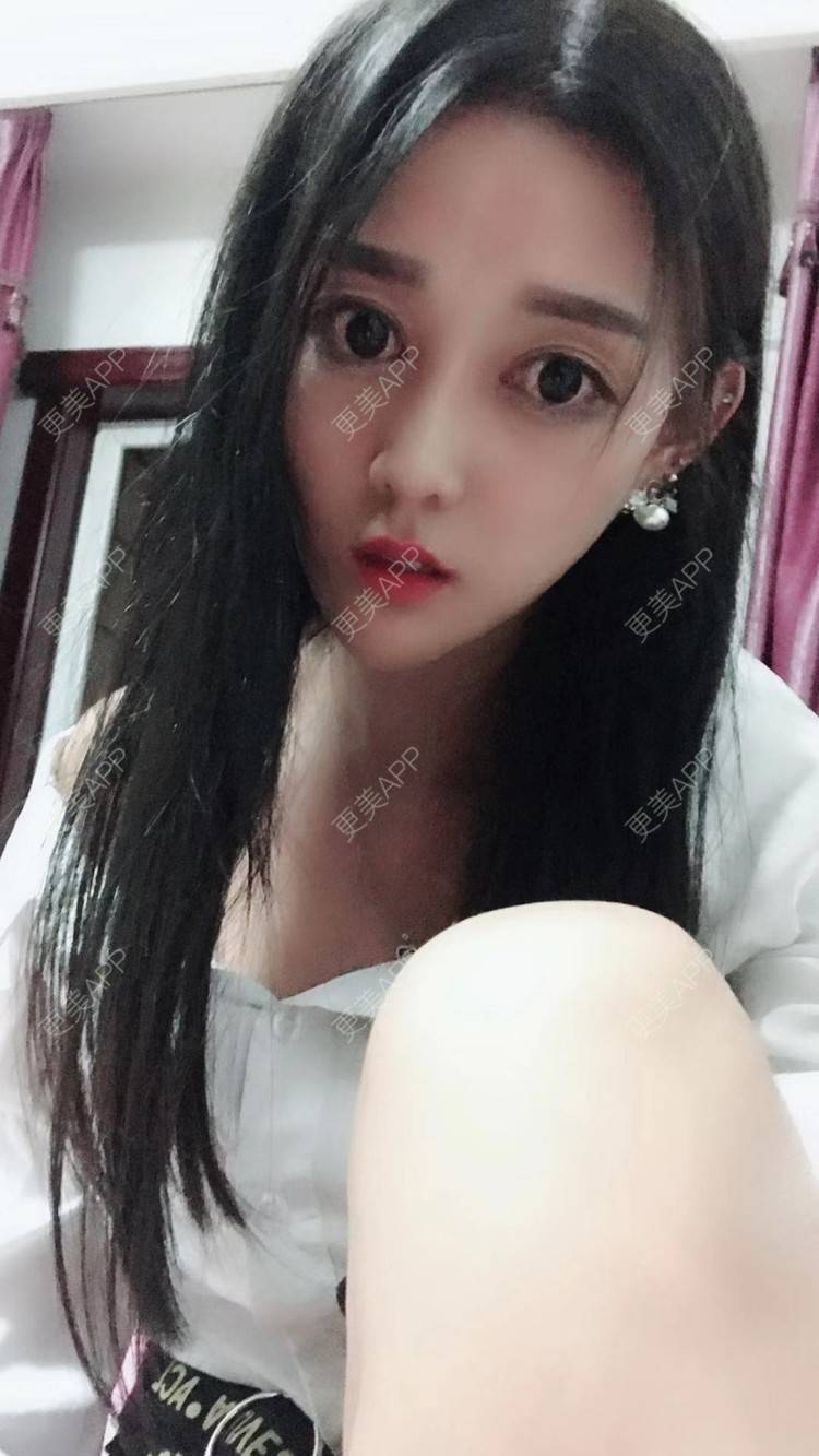 更美 - 玫瑰紫的轮廓修复术经验 | 轮廓修复术