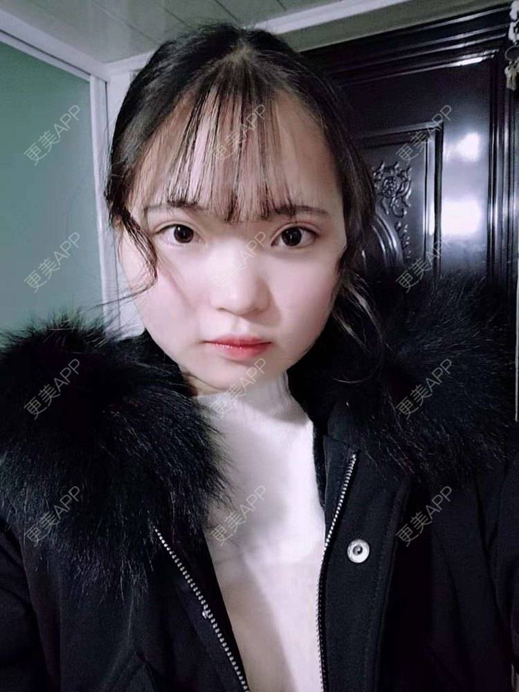 更美 - 刘晋军 医生的鼻部硅胶假体取出经验 | 鼻部修复 | 鼻形态修复 | 鼻部硅胶假体取出 | 南京