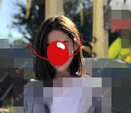 更美 - 更美用户BtHA0pILpQ的半永久纹发际线经验 | 北京 | 半永久纹发际线