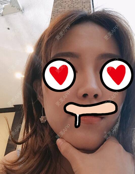 更美 - 雨中情人的经验 | 西安 | 阴蒂整形