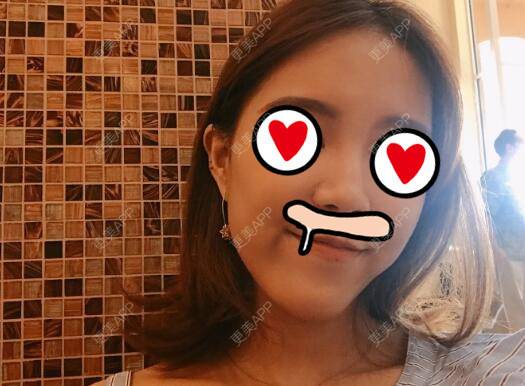 更美 - 雨中情人的经验 | 西安 | 阴蒂整形