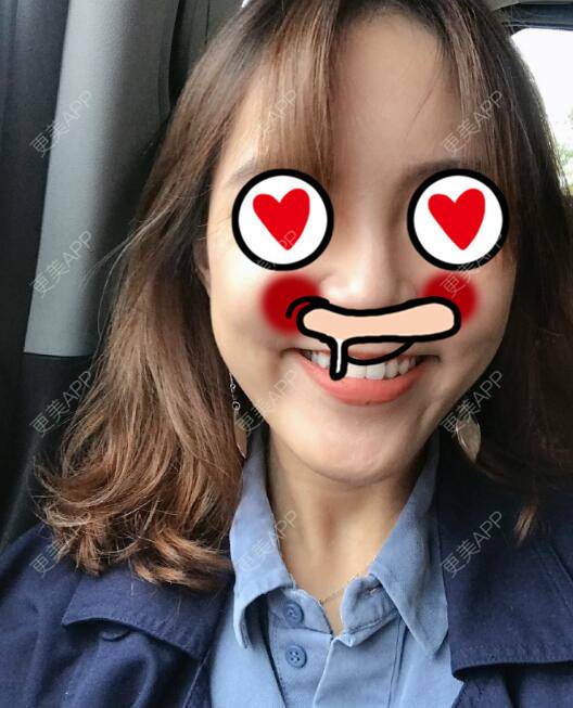 更美 - 雨中情人的经验 | 西安 | 阴蒂整形