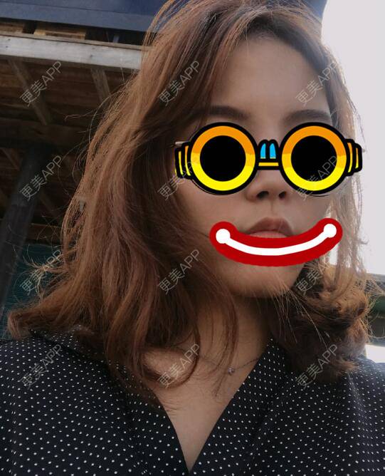 更美 - 雨中情人的经验 | 西安 | 阴蒂整形