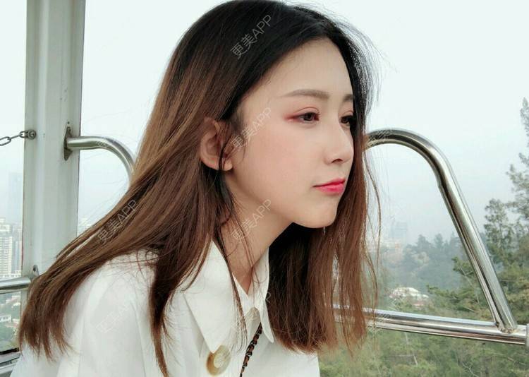 更美 - 傍晚雨后的超声波洗牙经验 | 成都 | 超声波洗牙