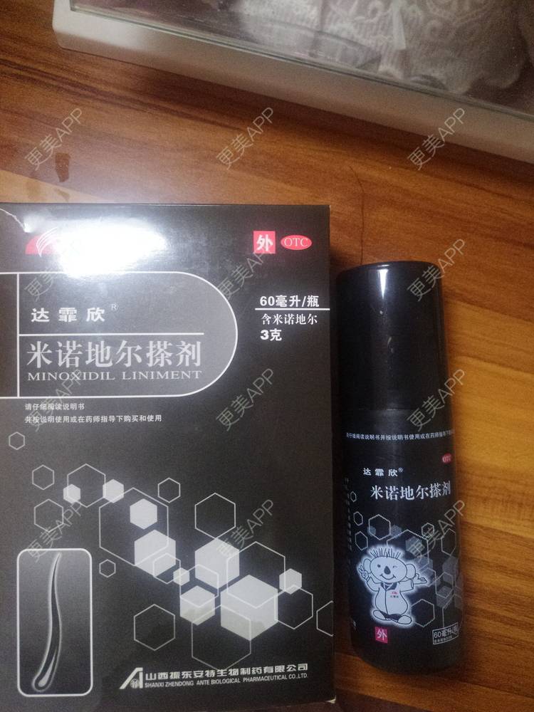 更美 - 大白的植发际线经验 | 植发际线 | 广州