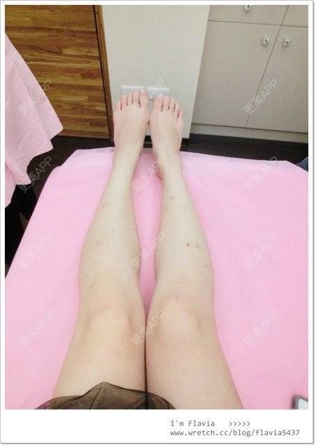 更美 - 星爸比的镭射净肤经验 | 镭射净肤 | 上海