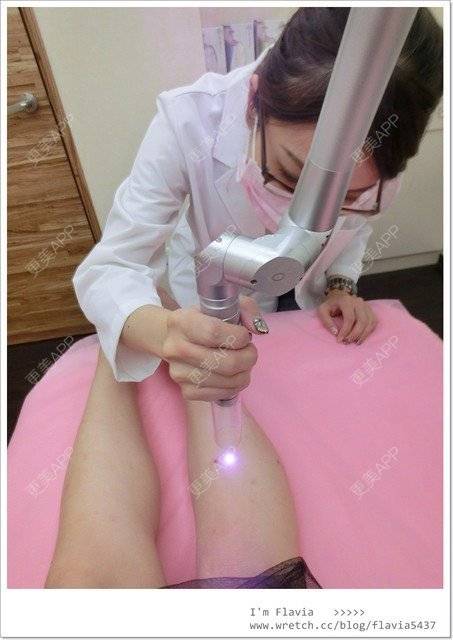 更美 - 星爸比的镭射净肤经验 | 镭射净肤 | 上海