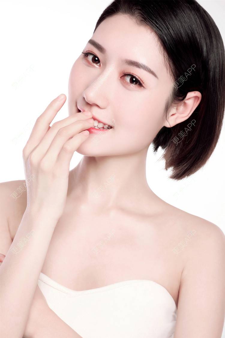 膨体隆鼻效果图_媗媗膨体隆鼻效果图_术后182天__更美