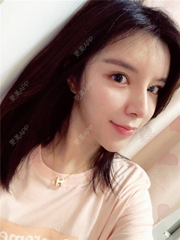 更美 - 罗莉 医生的鼻部多项经验 | 福州 | 鼻部多项