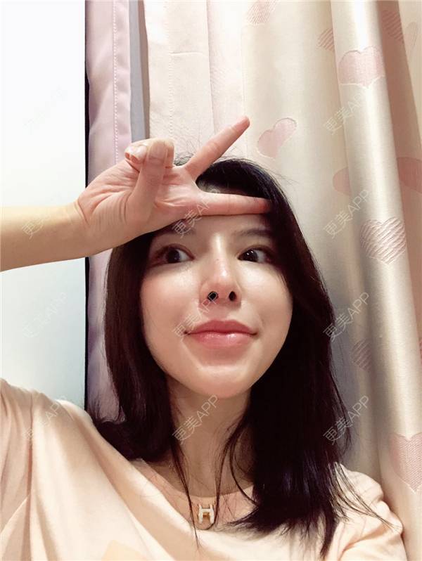 更美 - 罗莉 医生的鼻部多项经验 | 福州 | 鼻部多项