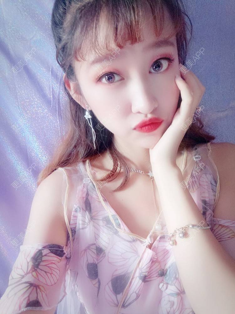更美 - 更美用户54uEUJyRUs的隆鼻经验 | 隆鼻 | 硅胶隆鼻 | 耳软骨隆鼻 | 歪鼻矫正 | 鼻翼缩小 | 温州